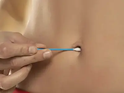 O que acontece quando o umbigo não é bem higienizado.