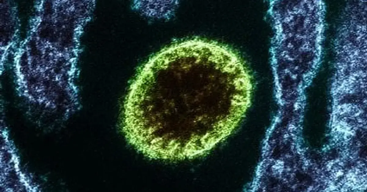 Ministérios e países aceleram alerta por surto do vírus Nipah na Índia