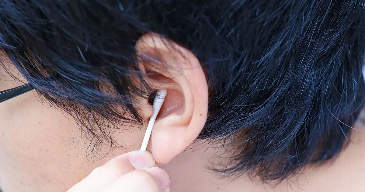 Procedimento de limpeza de ouvido mostrando a cera auricular