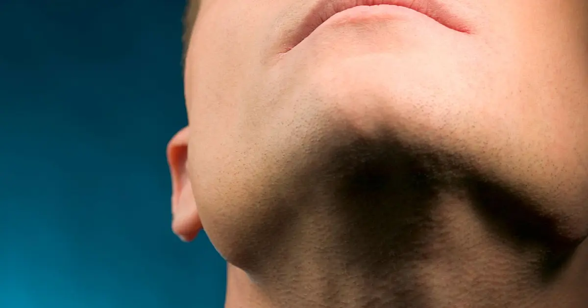 Imagem aproximada da região do queixo e pescoço masculino destacando a área da papada.