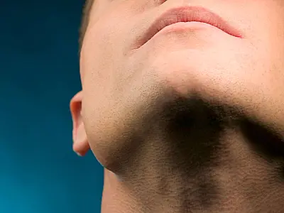 Exercícios e postura adequada podem ajudar a reduzir a papada e melhorar o contorno facial.