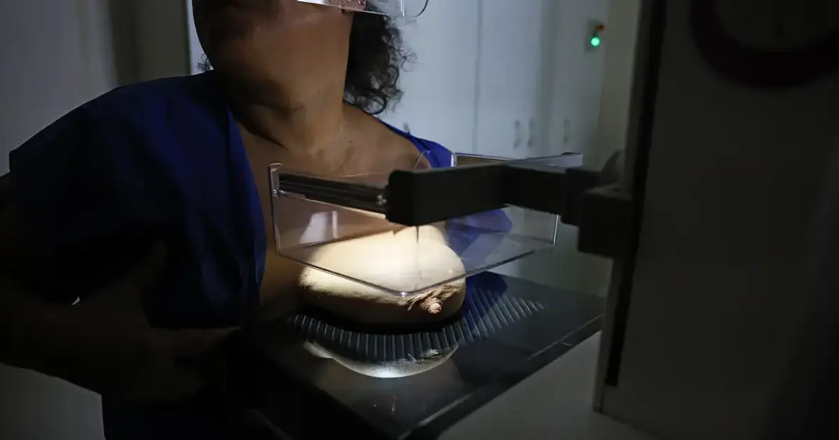 Avanço histórico: 92% das mulheres de 50 a 69 anos no Brasil já realizaram mamografia, aponta pesquisa Vigitel do Ministério da Saúde