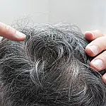 Hábitos do dia a dia podem acelerar o surgimento de cabelos brancos