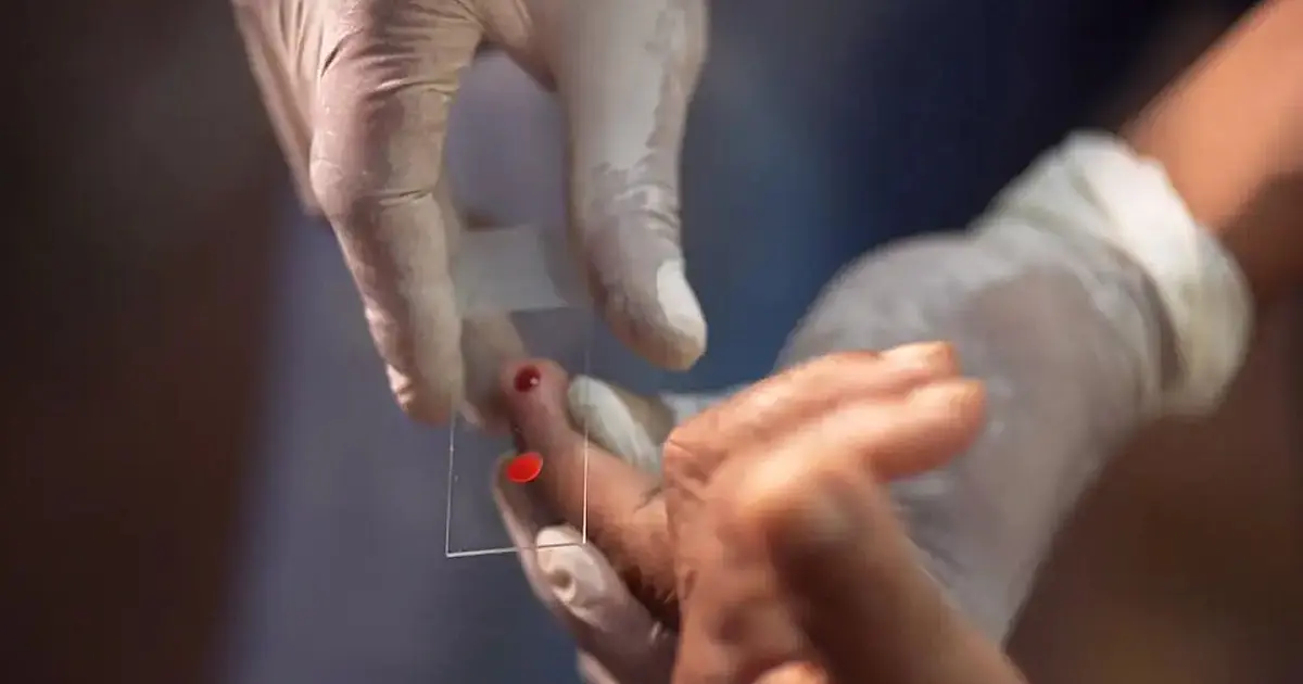 profissionais de saúde realizando atendimento relacionado ao tratamento contra malária em unidade do SUS