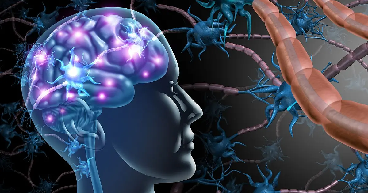 Ilustração de cérebro com tecnologia representando implante neural.