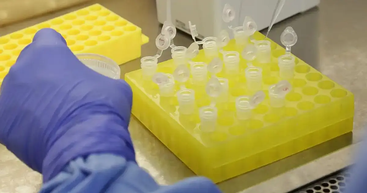 Imagem ilustrativa do vírus do sarampo usada em divulgação científica sobre a doença.