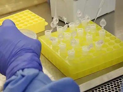 São Paulo confirmou o segundo caso importado de sarampo registrado em 2026.