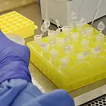 São Paulo confirma segundo caso importado de sarampo em 2026