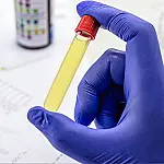 Lei exige teste toxicológico e presidente defende regra após eleição