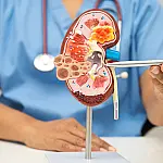 Alimentos que podem aumentar o risco de pedra nos rins, segundo especialistas