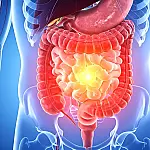 Semente milenar ajuda a controlar o açúcar no sangue e melhora o trânsito intestinal